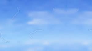 Floaters in the eye, medical symptom in optics