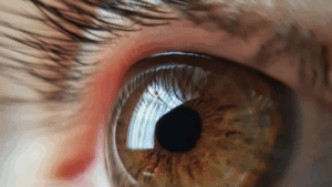 What Causes Eye Floaters?