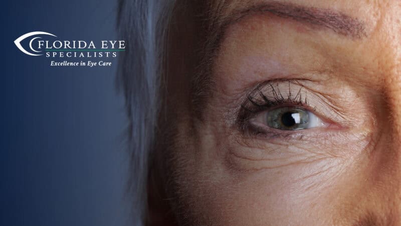 Self-Test for Cataracts [Quiz]