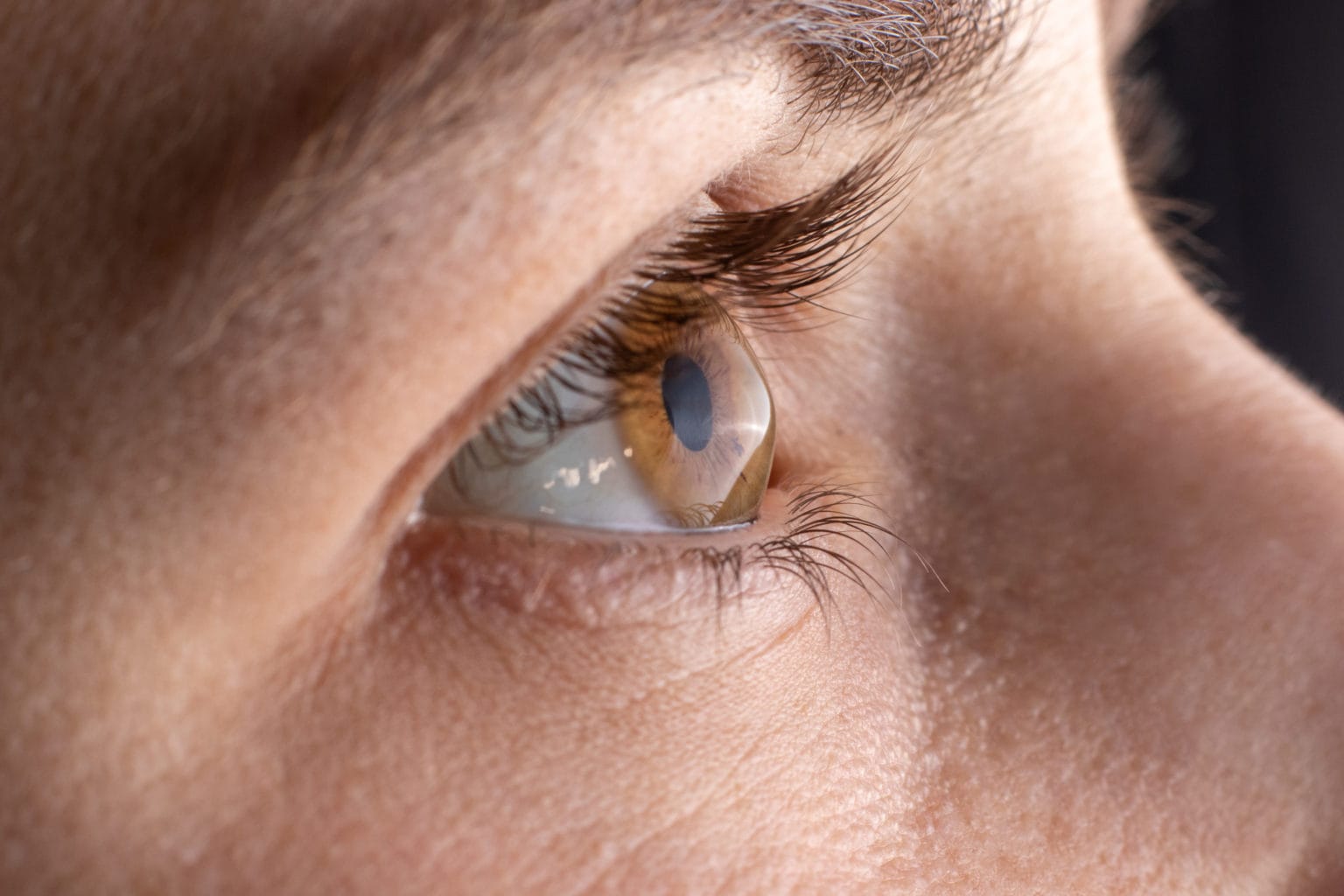 Close-up of an eye looking away from the camera